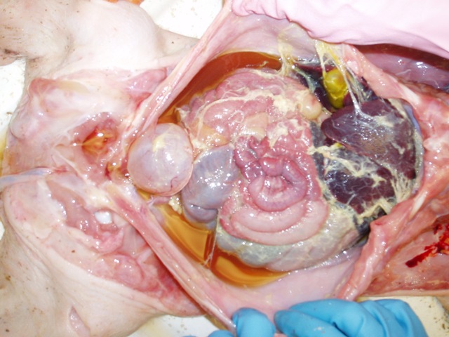 pleuritis fibrinoza + exudat.JPG